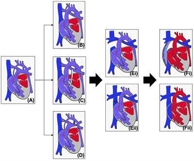 Noninvasive Imaging in Interventional Cardiology: Hypoplastic Left Heart Syndrome